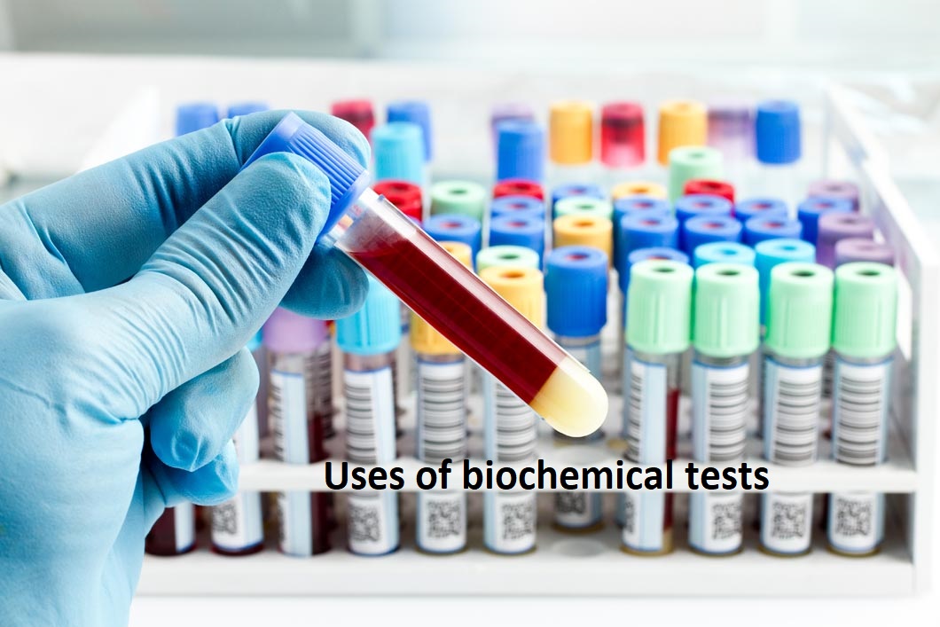 Biochemistry Test